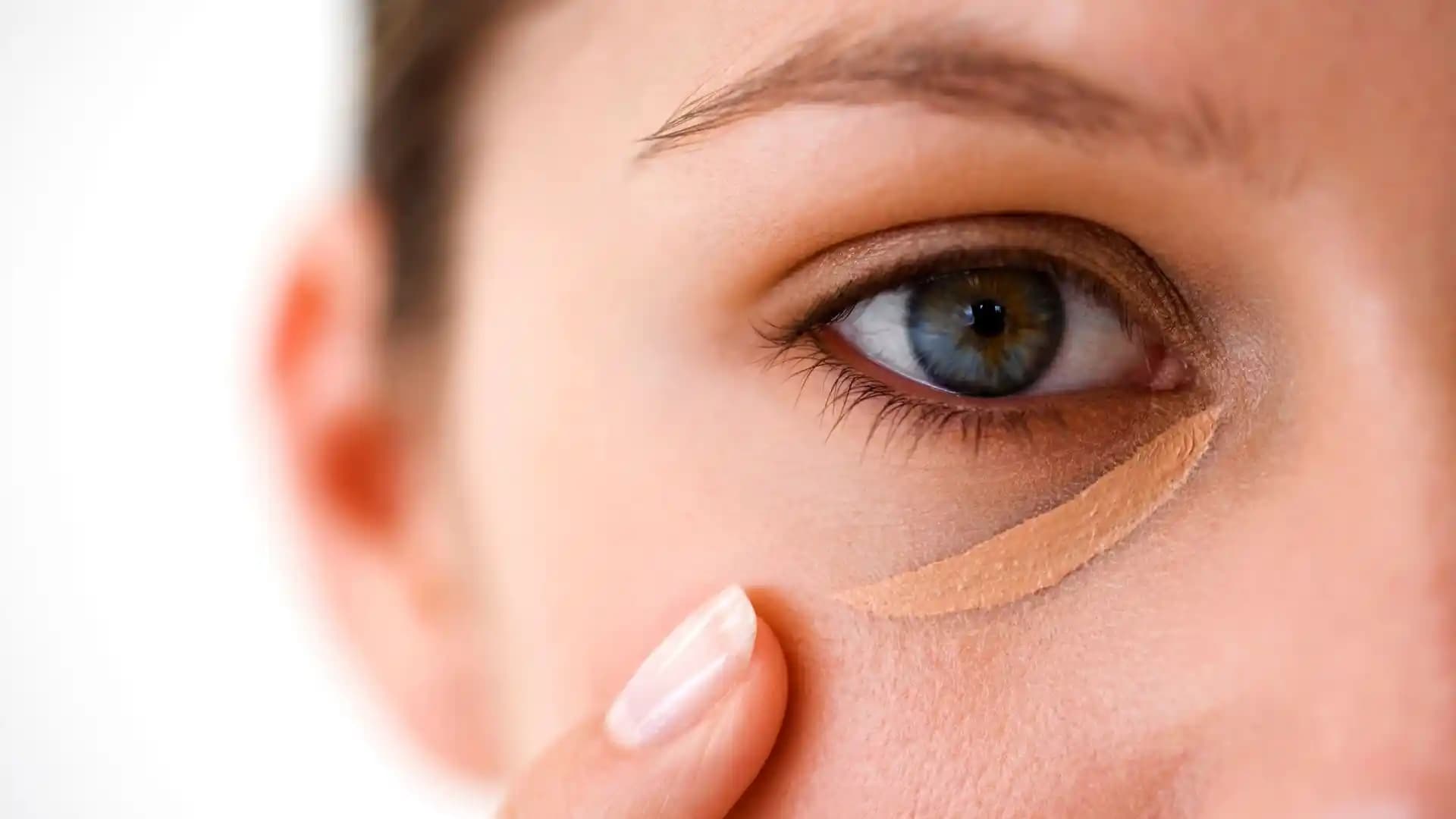 Göz Altı Komedonlarının Nedenleri ve Etkili Çözüm Yöntemleri