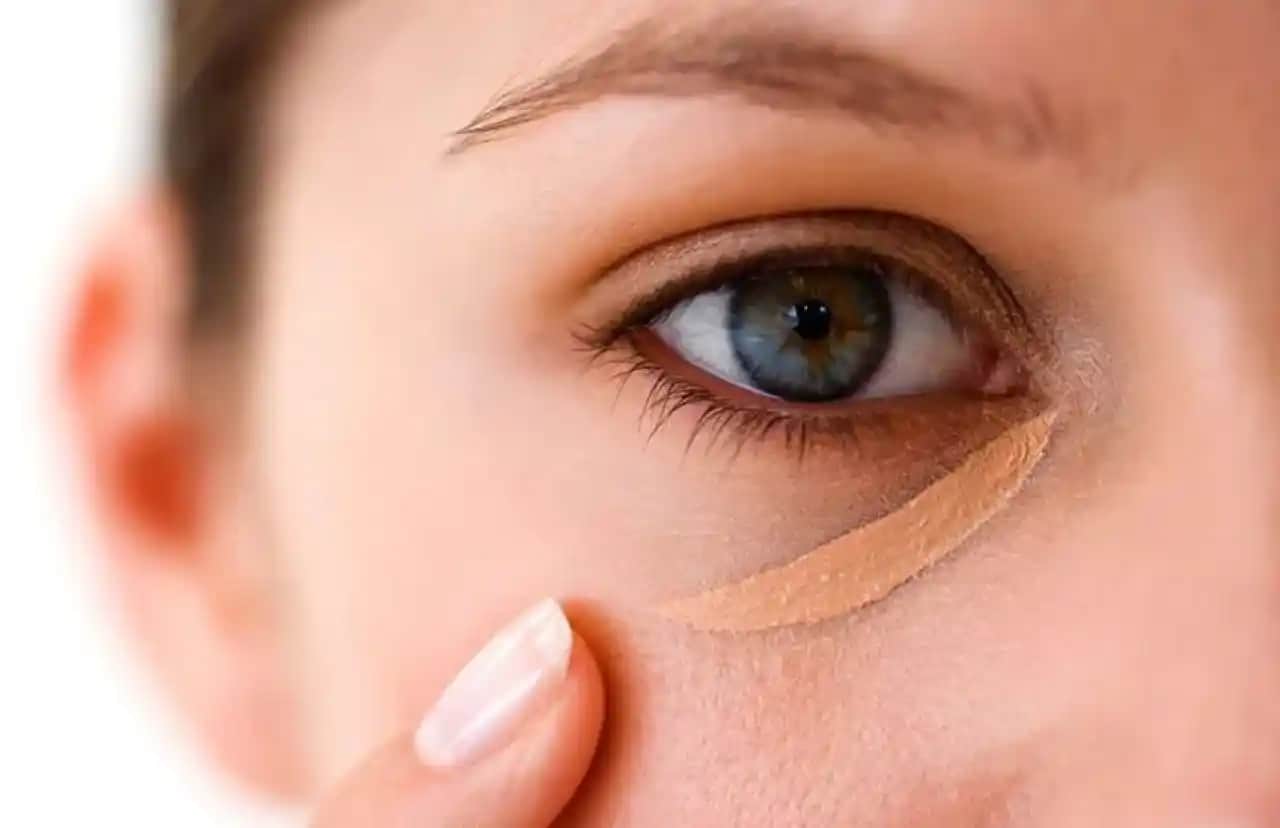 Göz Altı Morluklarına Karşı Etkili Çözüm Yöntemleri ve Bilinçli Bakım Tavsiyeleri