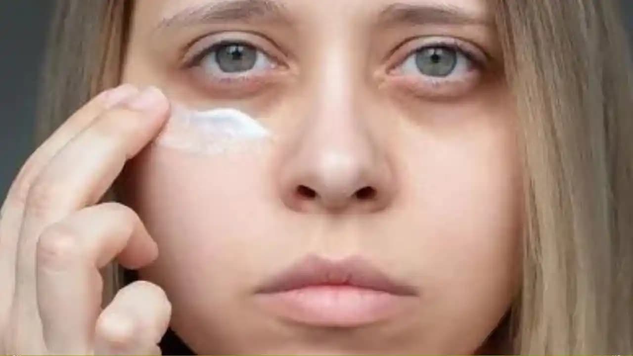 Göz Altı Morluklarına Karşı Etkili Yöntemler ve Doğal Çözüm Tavsiyeleri