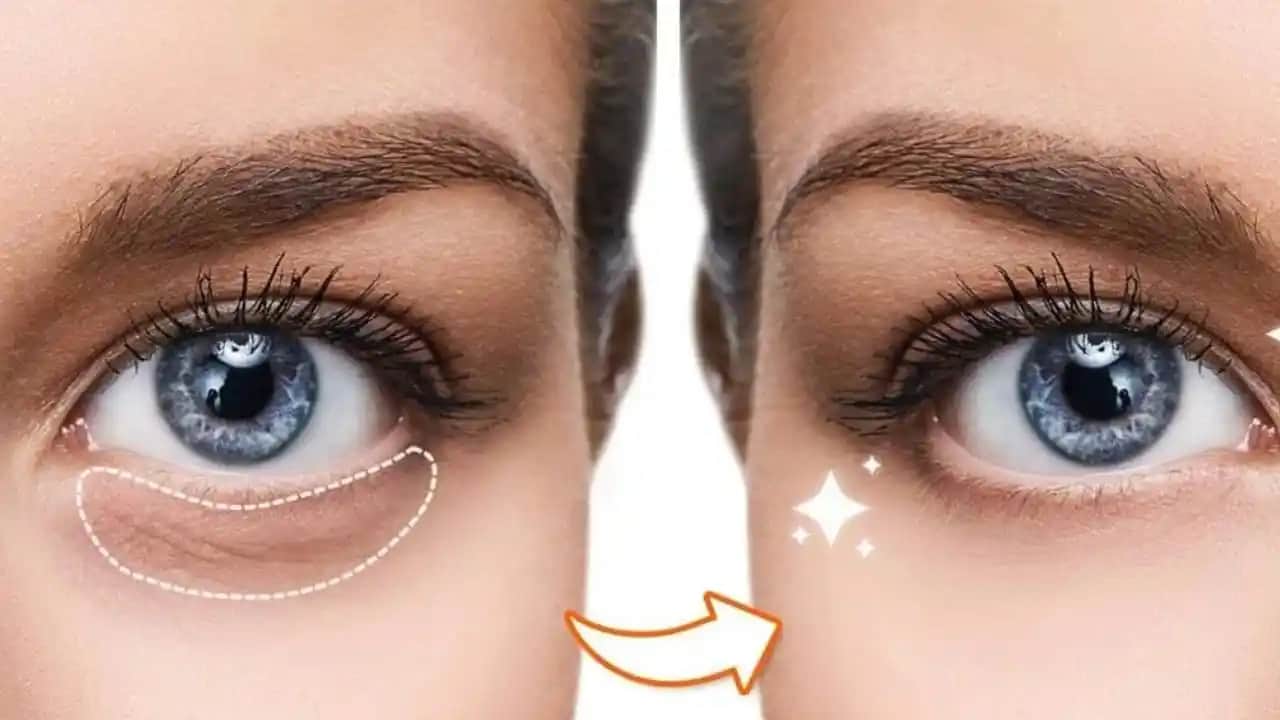 Göz Altı Morluklarını Azaltma Yöntemleri ve Kalıcı Çözüm Önerileri