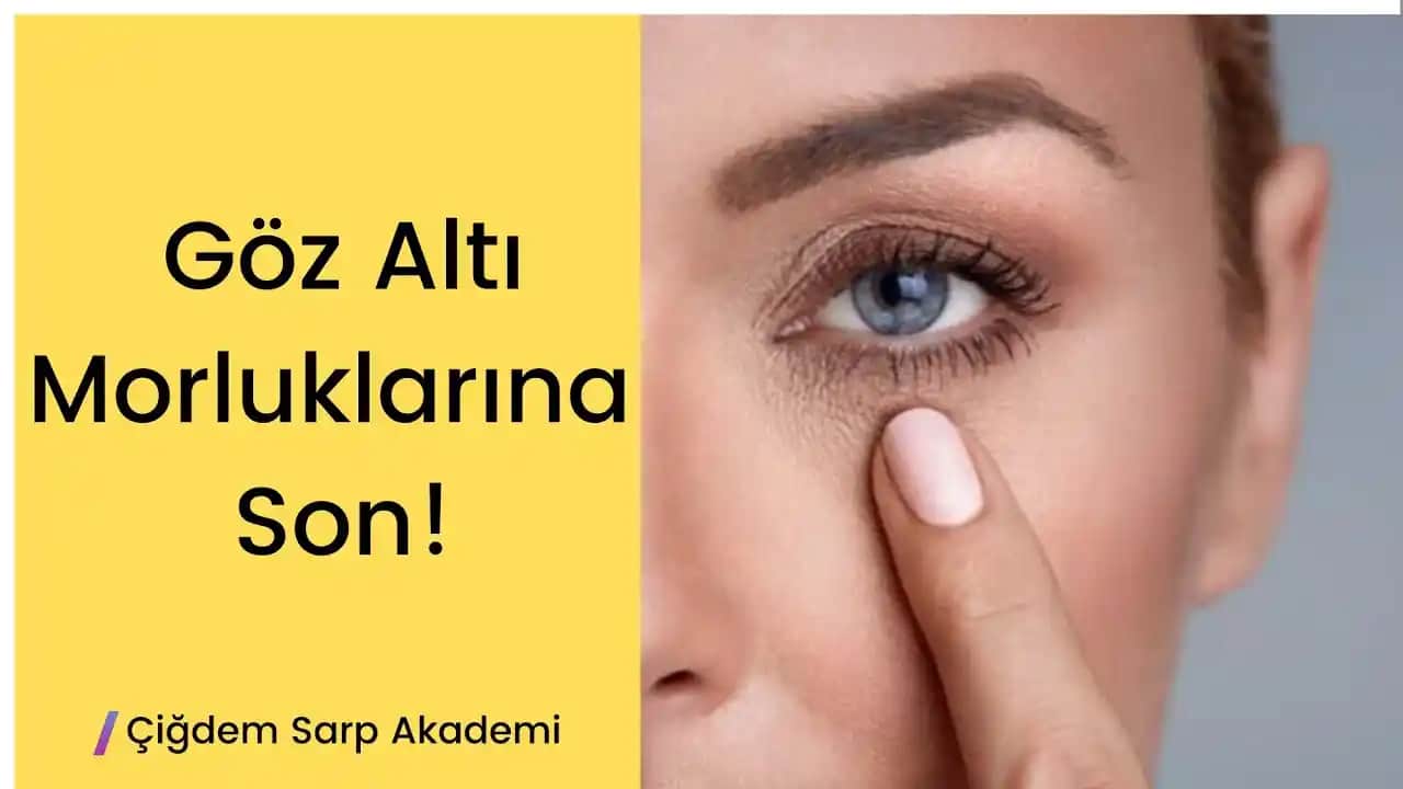 Göz Altı Morluklarını Gidermenin En Etkili Yöntemleri ve İpuçları