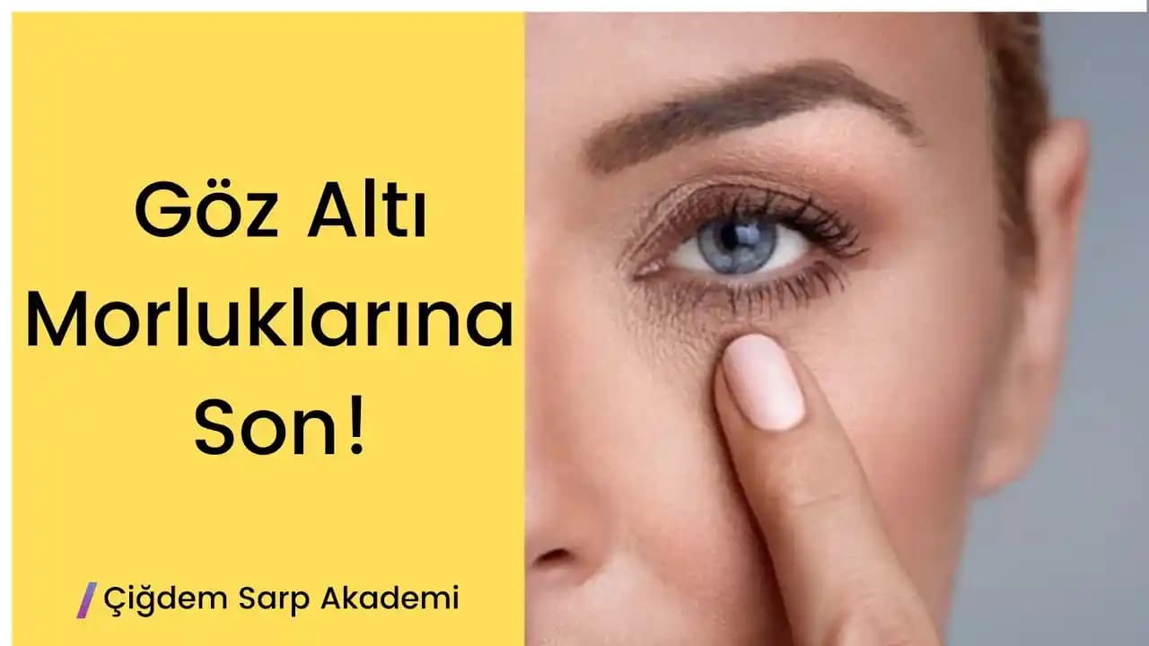 Göz Altı Morluklarını Gidermenin En Etkili Yöntemleri ve İpuçları