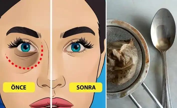 Göz Altı Şişliği Nasıl Geçer: Etkili Yöntemler ve Kalıcı Çözüm Önerileri