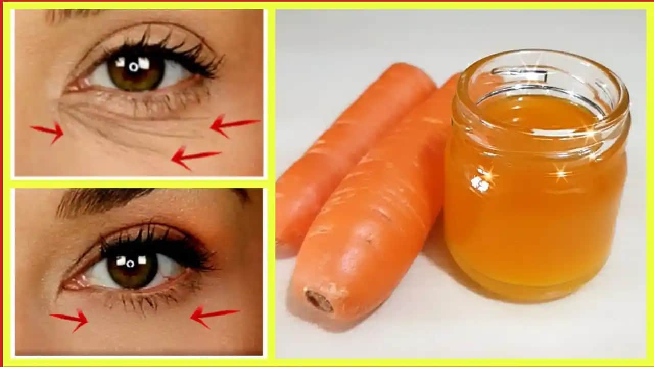 Göz Çevresi Kırışıklıklarını Azaltmak İçin Etkili Bakım ve Tedavi Yöntemleri