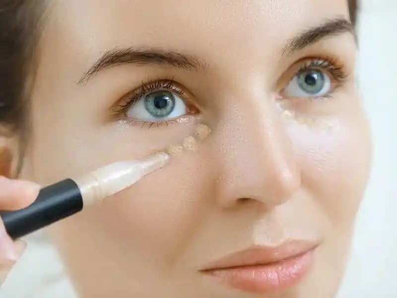 Göz Çevresi Morluklarının Nedenleri ve Etkili Giderme Yöntemleri