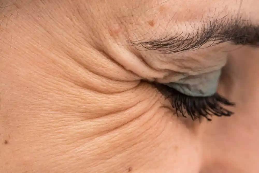 Göz Kaz Ayağı Nedir, Çeşitleri ve Güzellikteki Rolü Hakkında Detaylı Bilgi