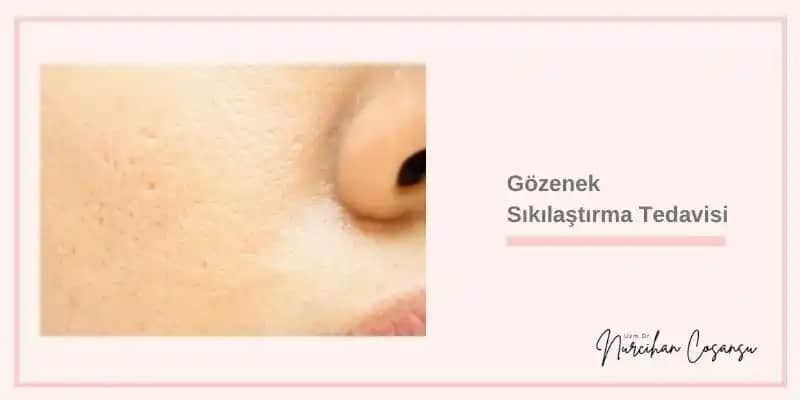 Gözenek Açma ve Küçültme Yöntemleri: Sağlıklı ve Pürüzsüz Bir Cilt İçin Adımlar