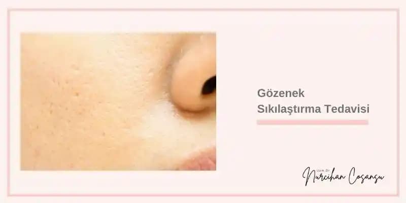 Gözenek Açma ve Küçültme Yöntemleri: Sağlıklı ve Pürüzsüz Bir Cilt İçin Adımlar