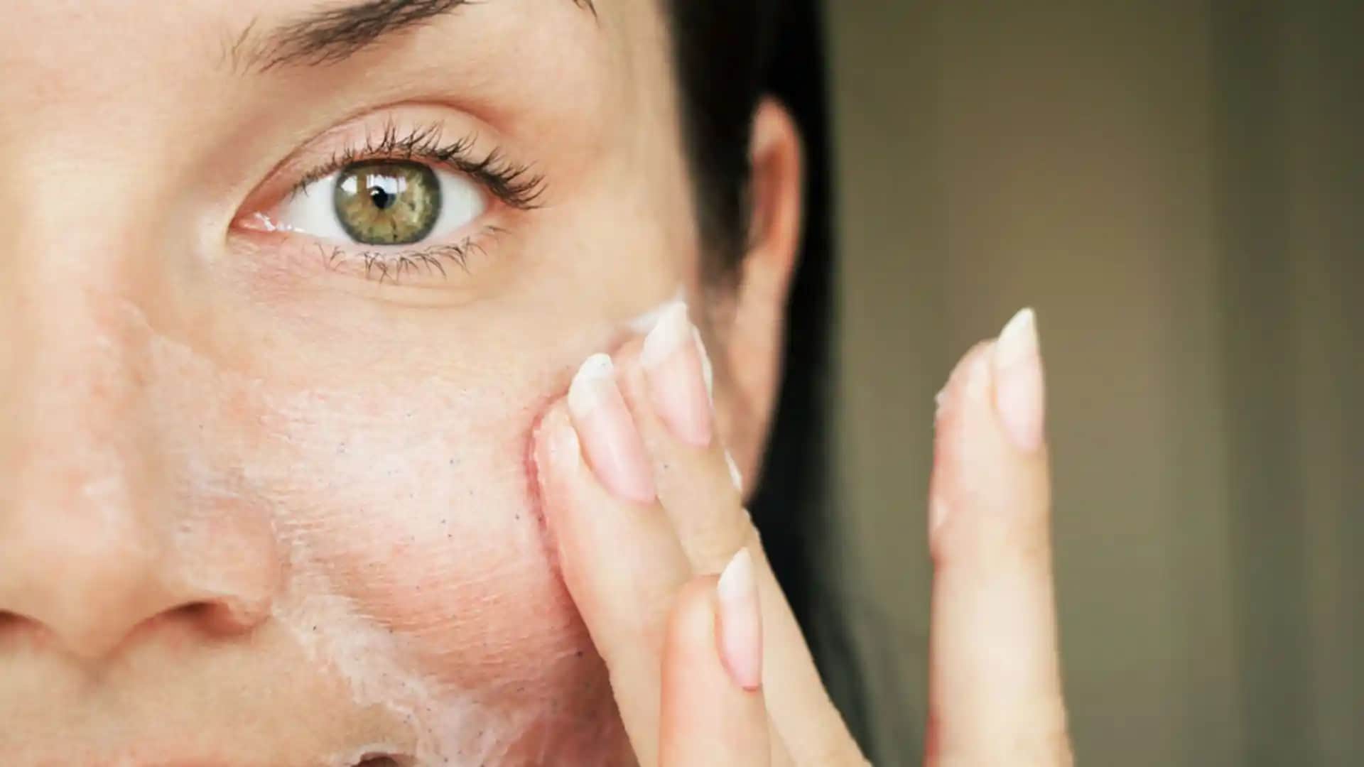 Gözenek Tıkanıklığı ve Açma Yöntemleri Uzman Tavsiyeleriyle Açıklanıyor