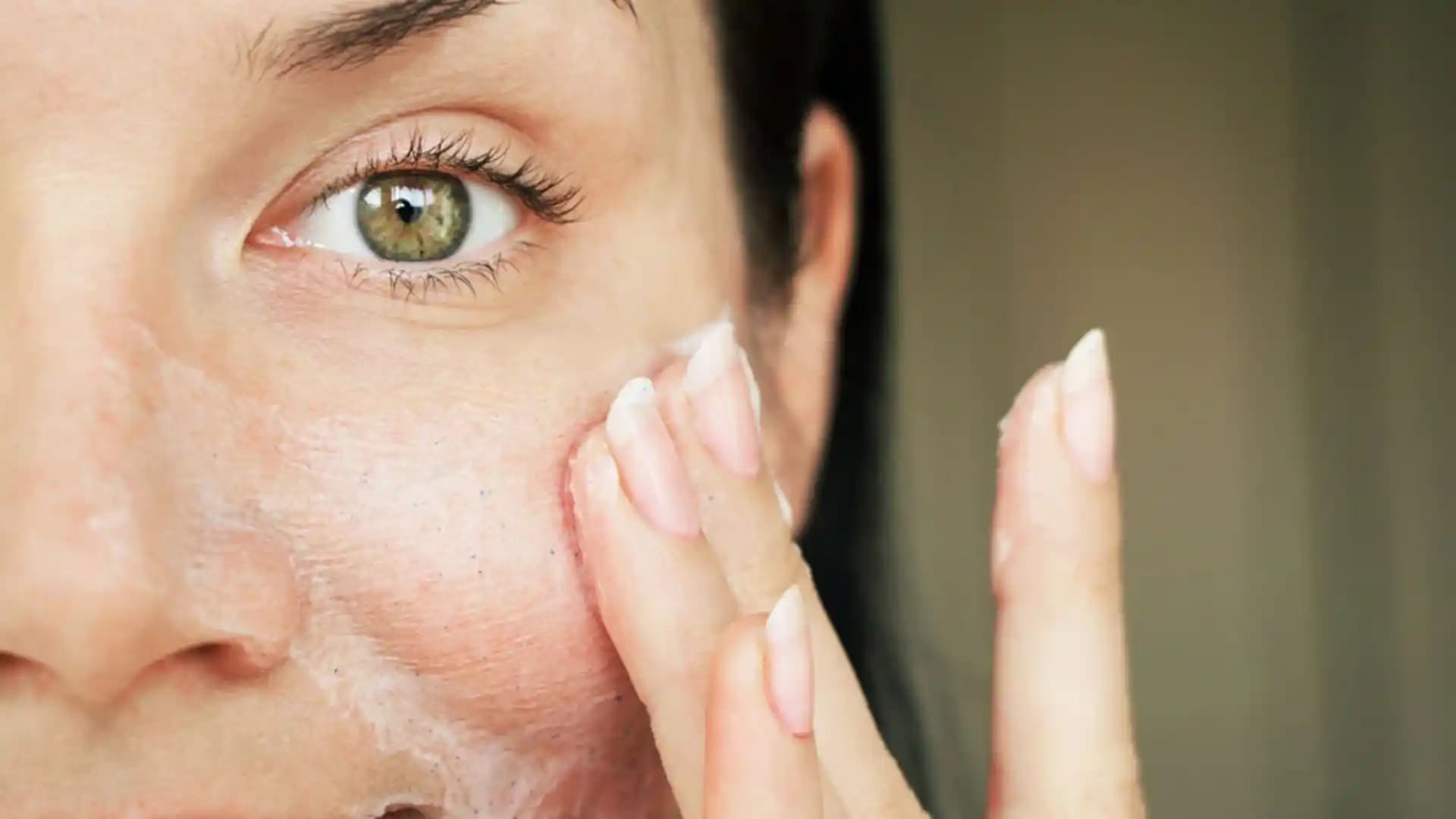 Gözenek Tıkanıklığı ve Açma Yöntemleri Uzman Tavsiyeleriyle Açıklanıyor