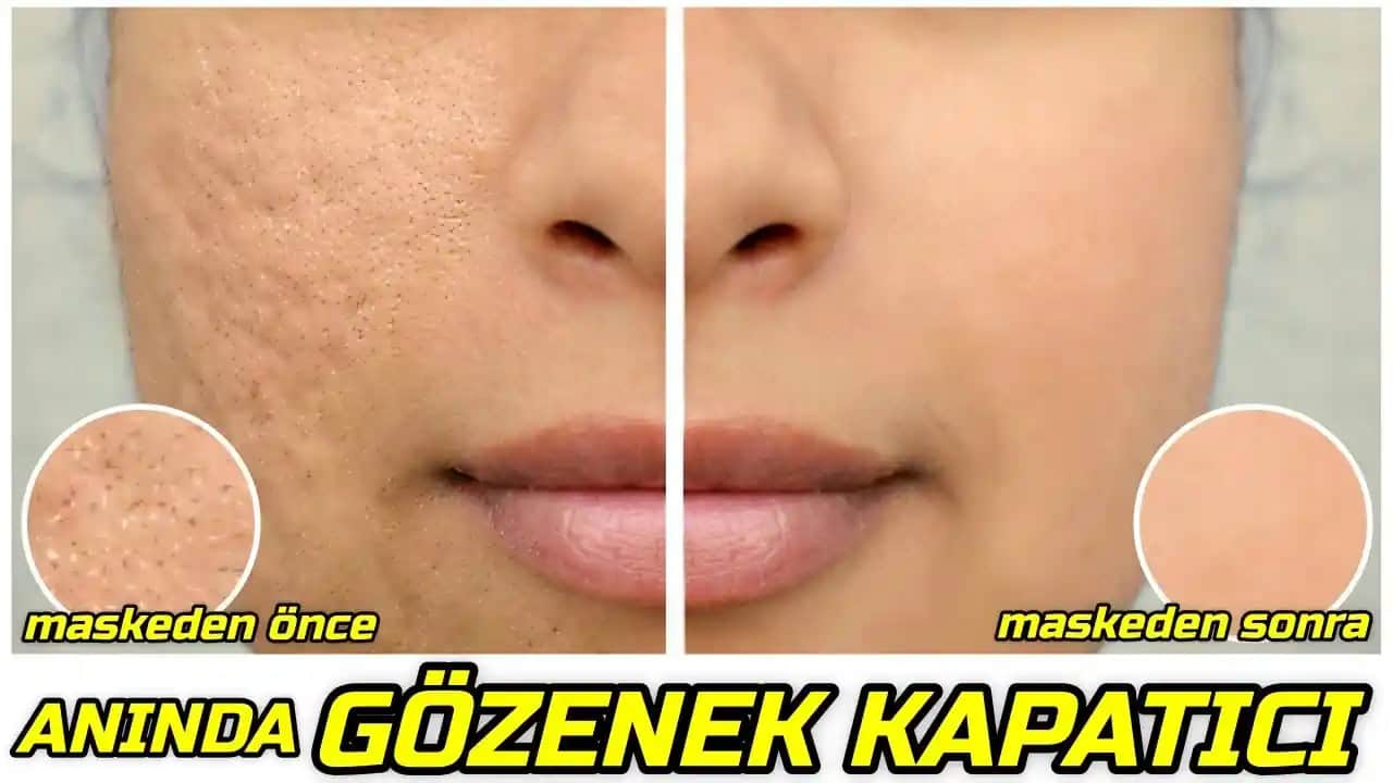 Gözenekleri Açma ve Temizleme Yöntemleri: Cilt Sağlığını Koruma Rehberi