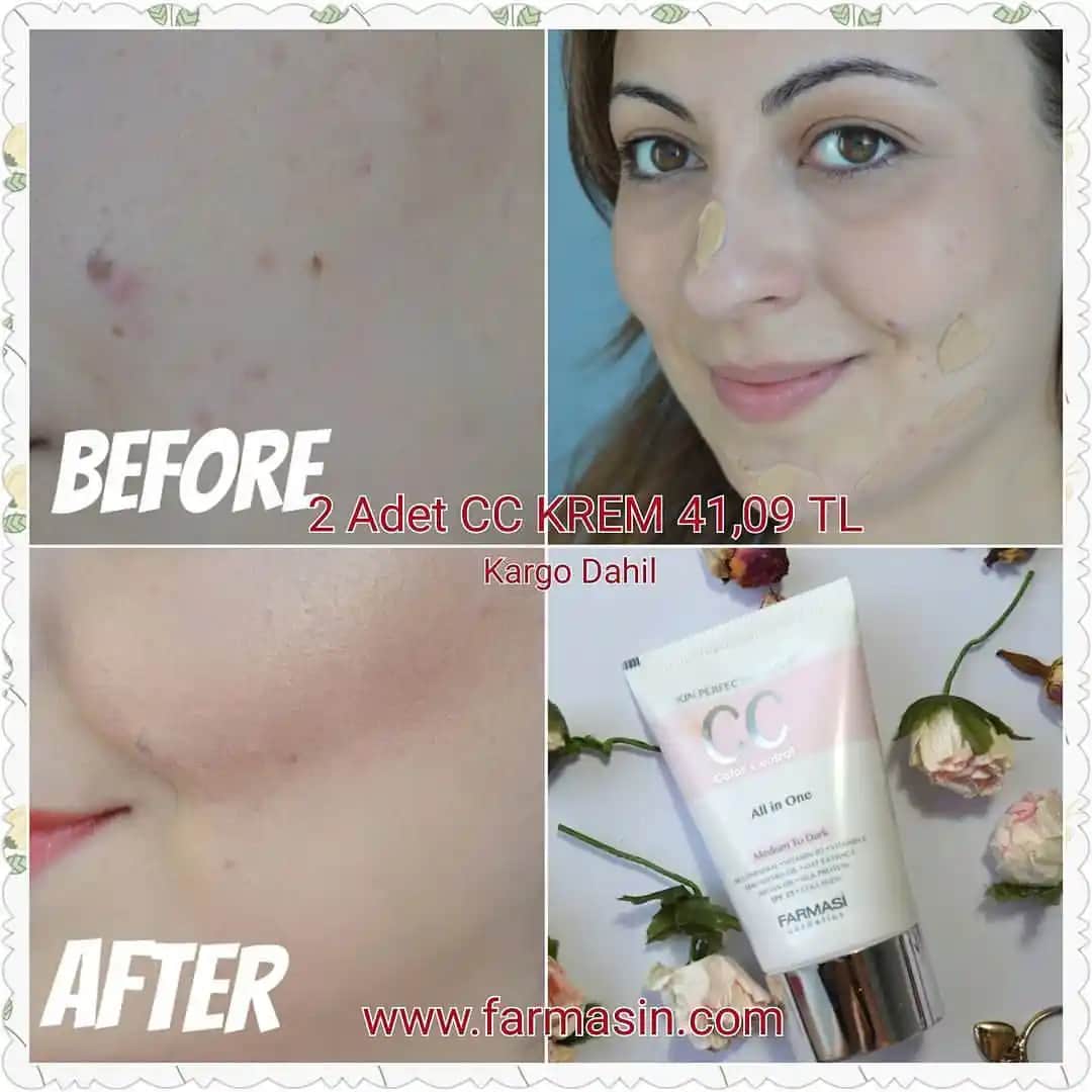 Gözenekleri Kapatan Kremler: Cilt Sağlığını Destekleyen Doğru Kullanım ve İçerik Bilgileri