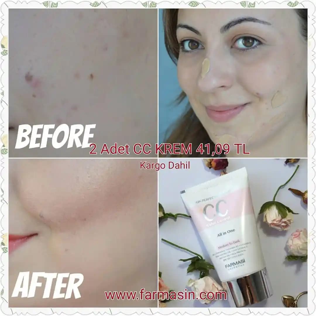 Gözenekleri Kapatan Kremler: Cilt Sağlığını Destekleyen Doğru Kullanım ve İçerik Bilgileri