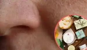 Gözenekleri Küçültmek İçin Etkili Yöntemler ve Cilt Sağlığını Destekleyen İpuçları