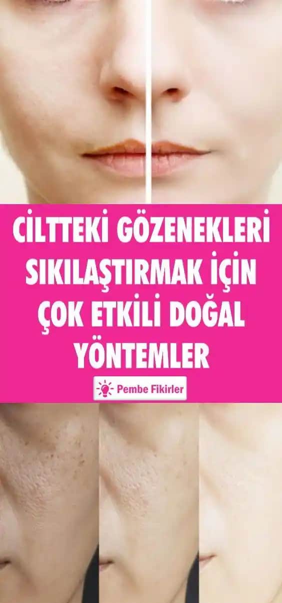 Gözeneklerin Açık Olması Nedenleri ve Etkili Sıkılaştırma Yöntemleri