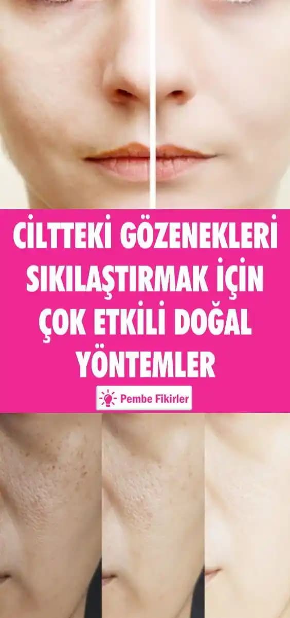 Gözeneklerin Açık Olması Nedenleri ve Etkili Sıkılaştırma Yöntemleri