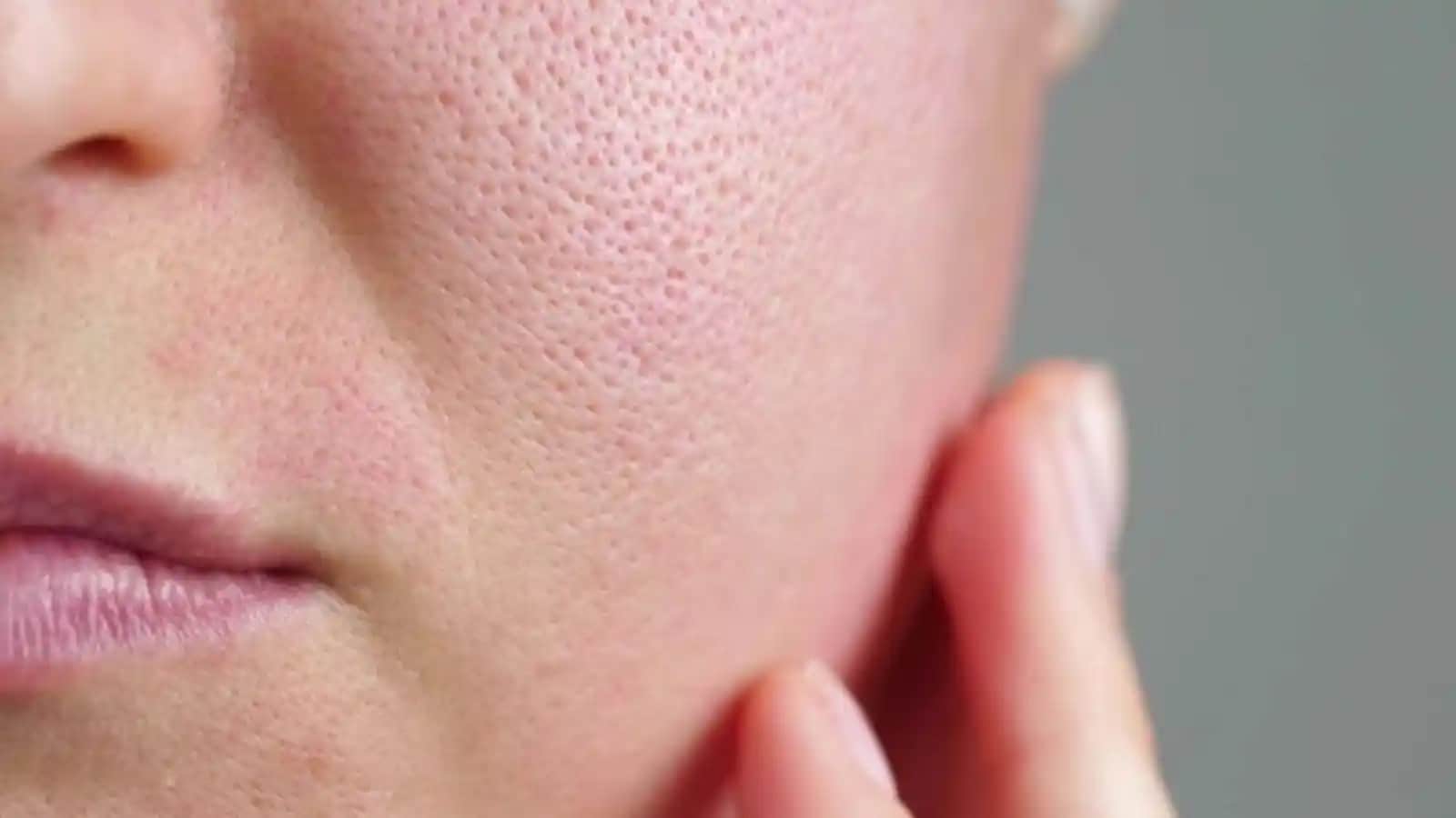 Gözeneklerin Büyüme Nedenleri ve Cilt Sağlığını Koruma Yöntemleri