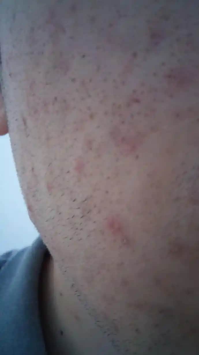 Gözeneklerin Neden Açıldığı ve Sağlıklı Görünüm İçin Uygulanabilir Yöntemler