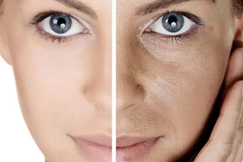 Gözenekli Cilt Tedavisi ve Bakım Yöntemleri: Sağlıklı ve Pürüzsüz Cilt İçin Rehber