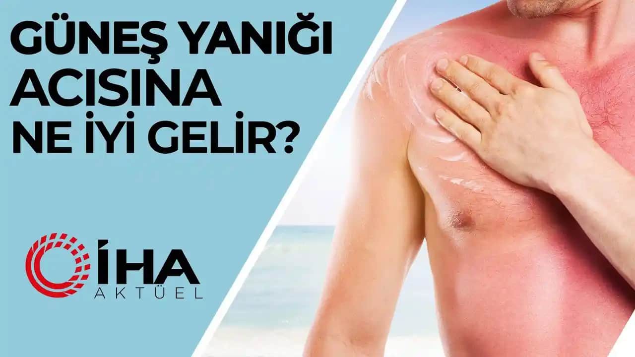 Güneş Yanığına Karşı Etkili Çözümler ve Cilt Sağlığını Koruma Yöntemleri