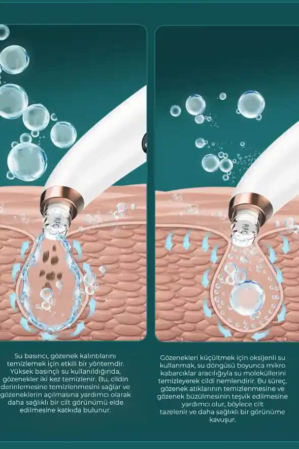 Güzellik Merkezi Siyah Nokta Temizliği Fiyatları ve Kalite Dengesi Hakkında Bilgi