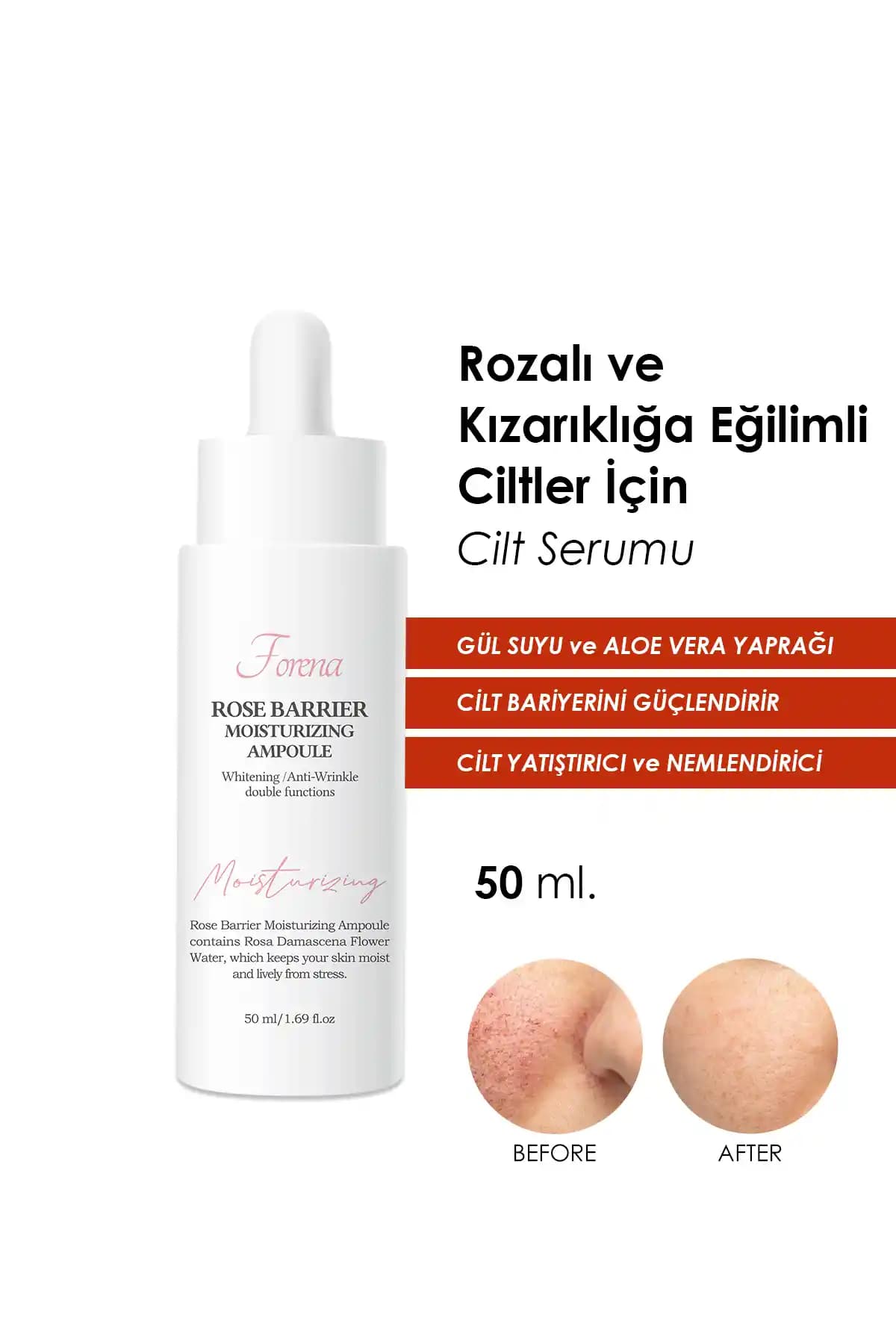 Hafif Rozalı Cilt İçin Doğru Bakım ve Sağlıklı Güzellik Yöntemleri