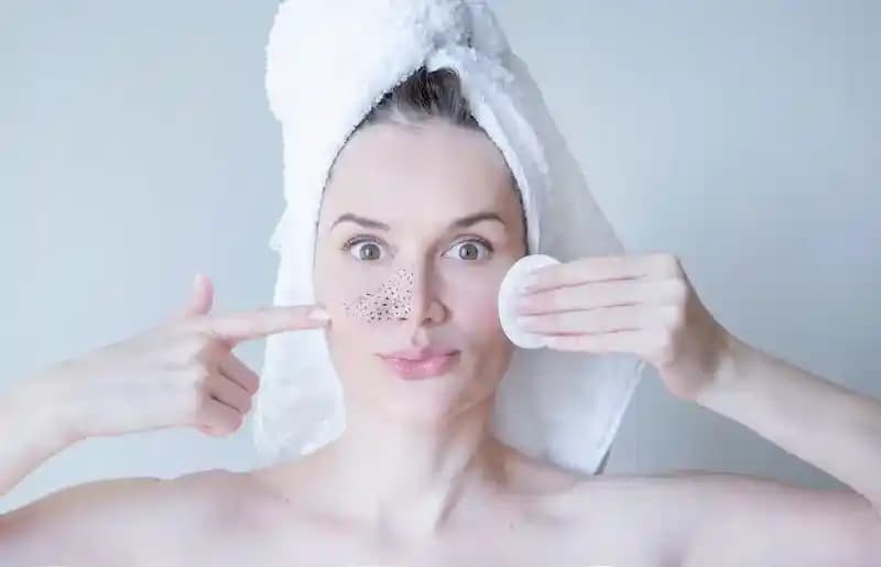 Hamilelikte Siyah Nokta Temizliği İçin Güvenli ve Etkili Yöntemler Rehberi