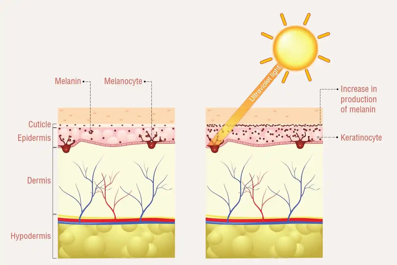 Hiperpigmentasyon Nedir, Nedenleri ve Etkili Çözüm Yöntemleri