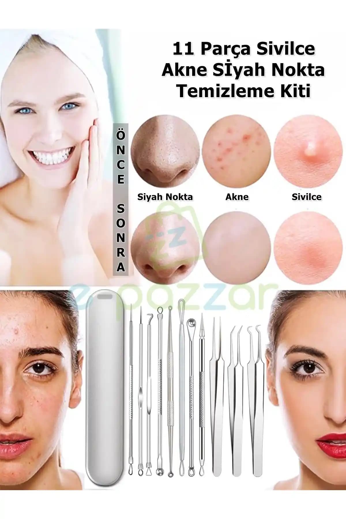 İçi Siyah Sivilceler: Nedenleri, Tedavi Yöntemleri ve Cilt Bakım İpuçları