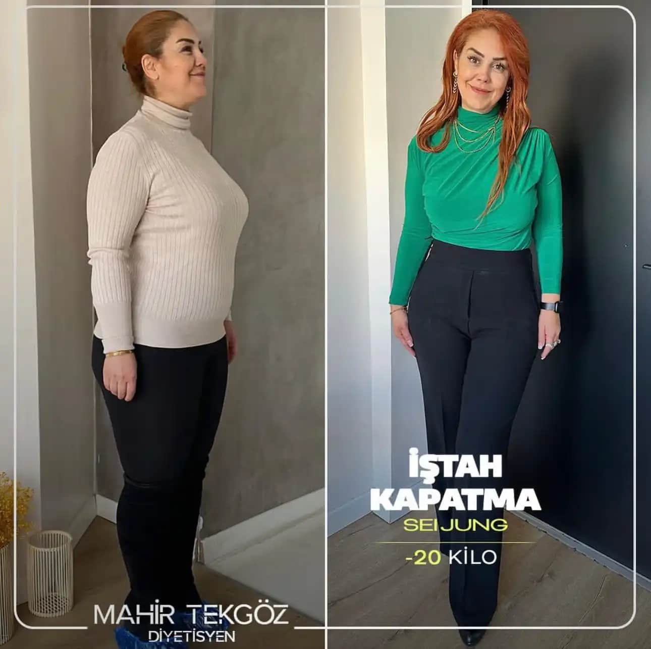 İştah Kapatan Takviyeler: Sağlık ve Estetik Amaçlar İçin Güvenilir Kullanım Rehberi