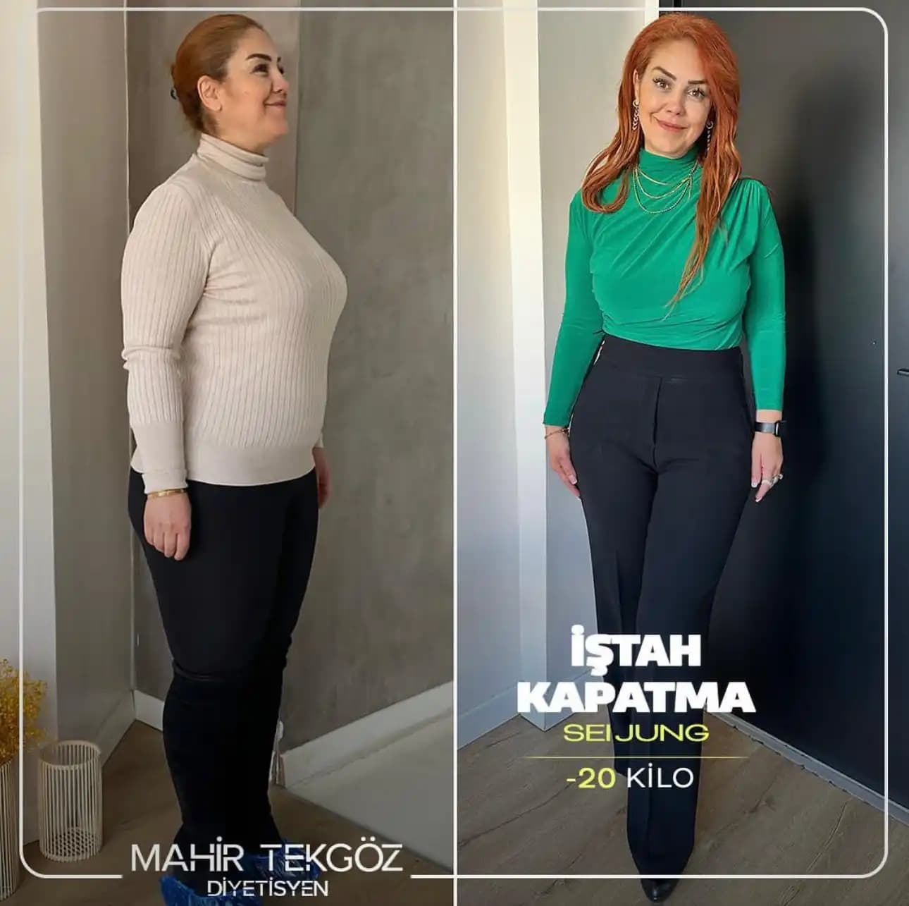 İştah Kapatan Takviyeler: Sağlık ve Estetik Amaçlar İçin Güvenilir Kullanım Rehberi