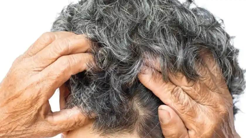 Kafa Kaşıntısının Nedenleri ve Etkili Çözüm Yöntemleri Hakkında Detaylı Bilgi