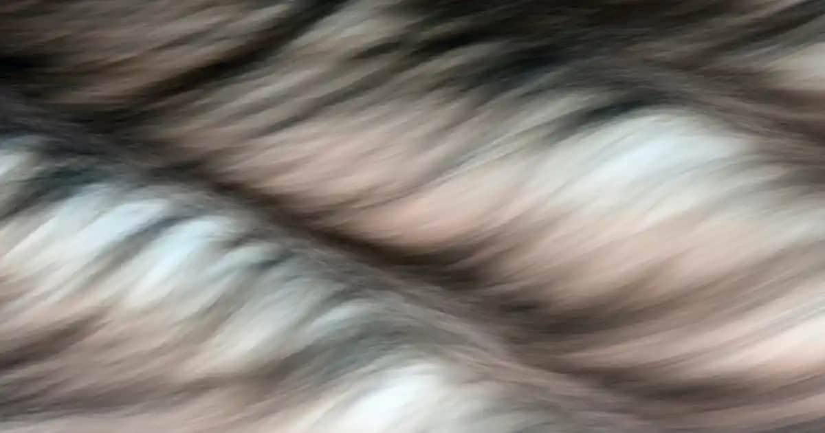 Kasıkta Sedef Hastalığı: Belirtileri, Nedenleri ve Etkili Bakım Yöntemleri