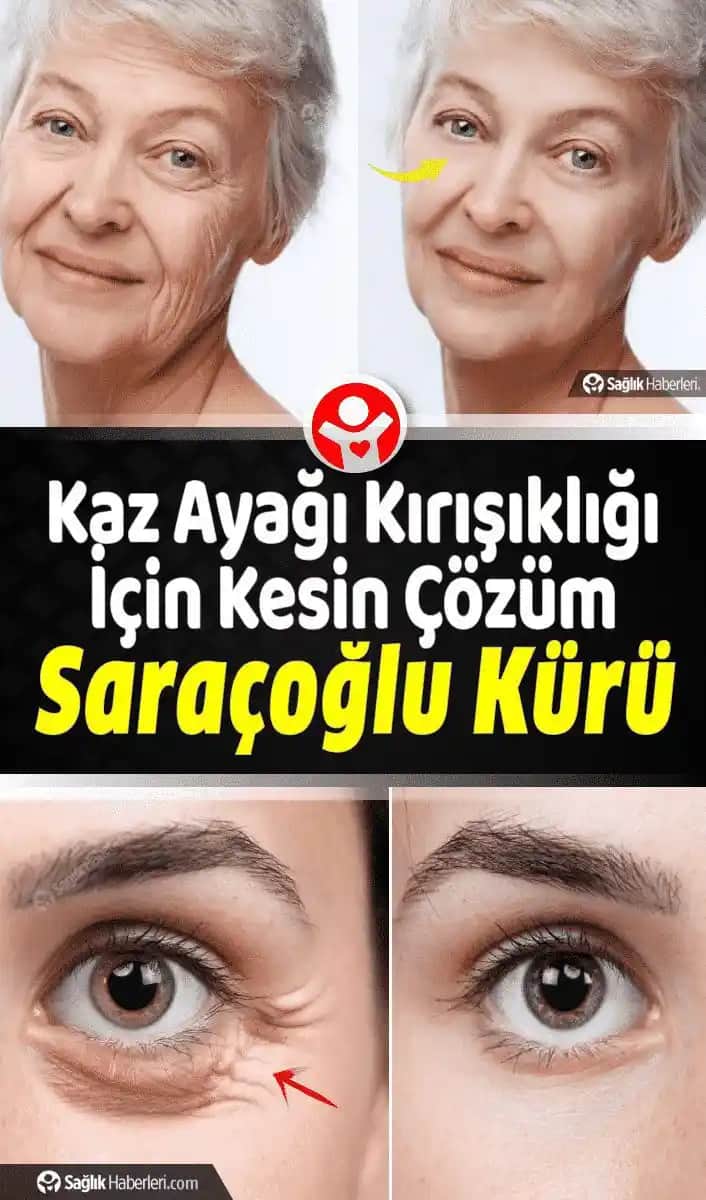 Kaz Ayağı Kırışıklıkları İçin Doğal Yöntemler ve Cilt Sağlığı İpuçları