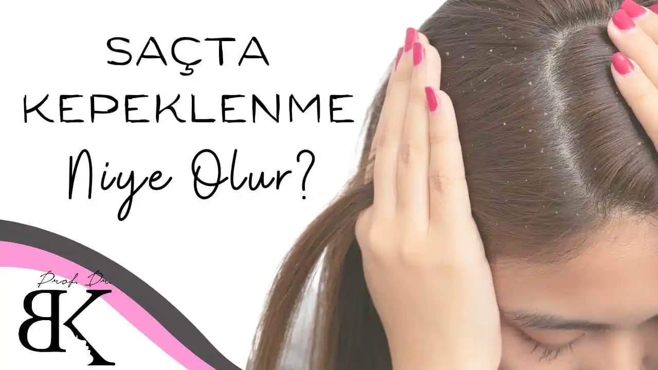 Kepeklenme Sorunu ve Saç Sağlığına Yönelik Etkili Yaklaşımlar ve Çözüm Yolları