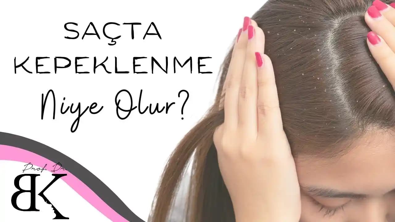 Kepeklenme Sorunu ve Saç Sağlığına Yönelik Etkili Yaklaşımlar ve Çözüm Yolları