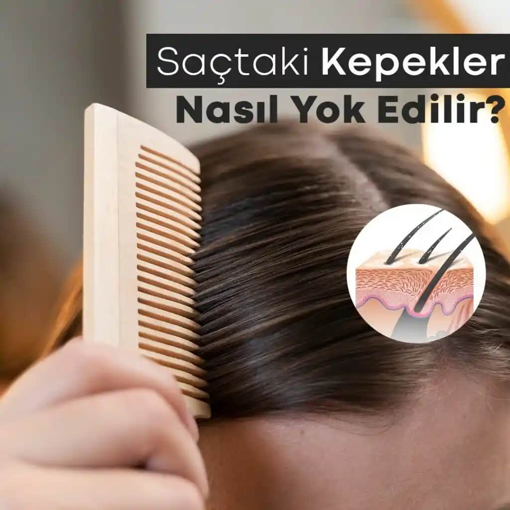 Keratin Sonrası Saçta Kabuklanma Nedenleri ve Etkili Çözüm Yolları
