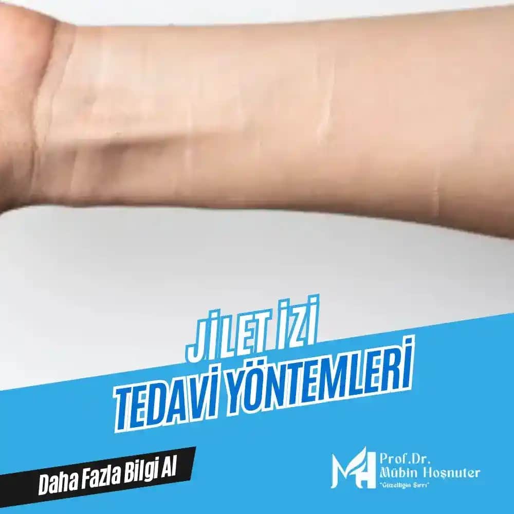 Kesik İzleri Nasıl Geçer Güzellik ve Bakımda İzlerin Önemi