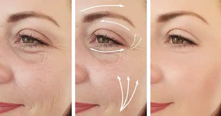 Kırışık Ciltle Mücadele Yöntemleri ve Sağlıklı Bir Görünüm İçin İpuçları