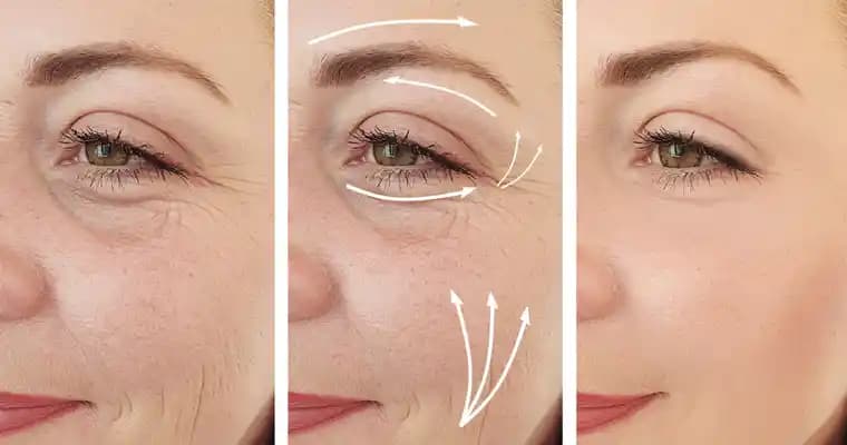 Kırışık Ciltle Mücadele Yöntemleri ve Sağlıklı Bir Görünüm İçin İpuçları