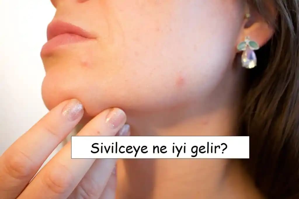 Kırmızı Sivilce İzleri Nedenleri ve Etkili Çözüm Yöntemleri Hakkında Detaylı Bilgi