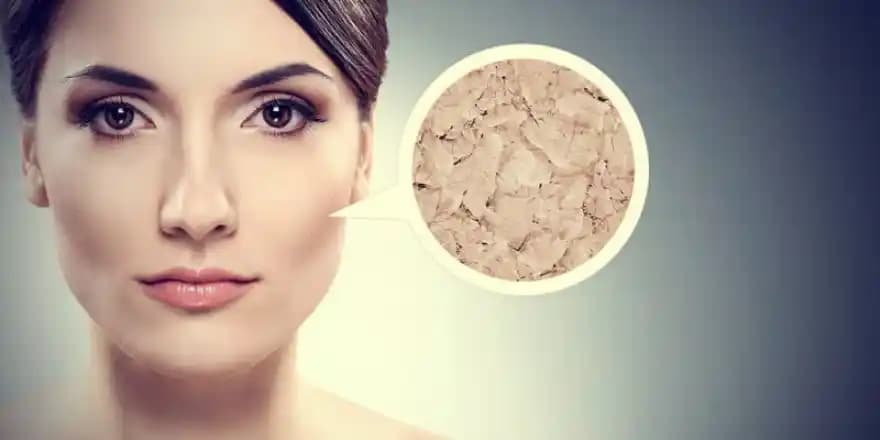 Kış Aylarında Yüz Kuruluğuna Karşı Etkili Bakım Yöntemleri ve Öneriler