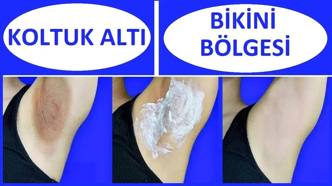 Kol Beyazlatma Yöntemleri ve Güvenilir Uygulamalar Hakkında Detaylı Bilgi