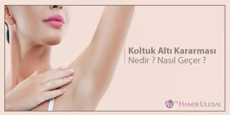 Kol Kararması Nasıl Geçer: Etkili Çözüm ve Bakım Yöntemleri