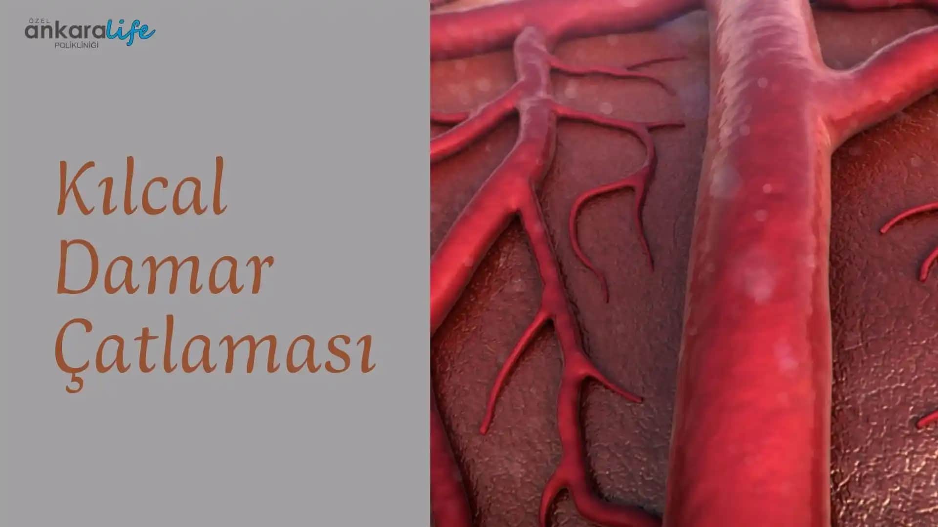 Kolda Kılcal Damar Çatlaması Nedenleri, Belirtileri ve Tedavi Yöntemleri