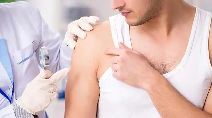 Koldaki Sivilceler: Nedenleri, Çözümleri ve Etkili Bakım Yöntemleri