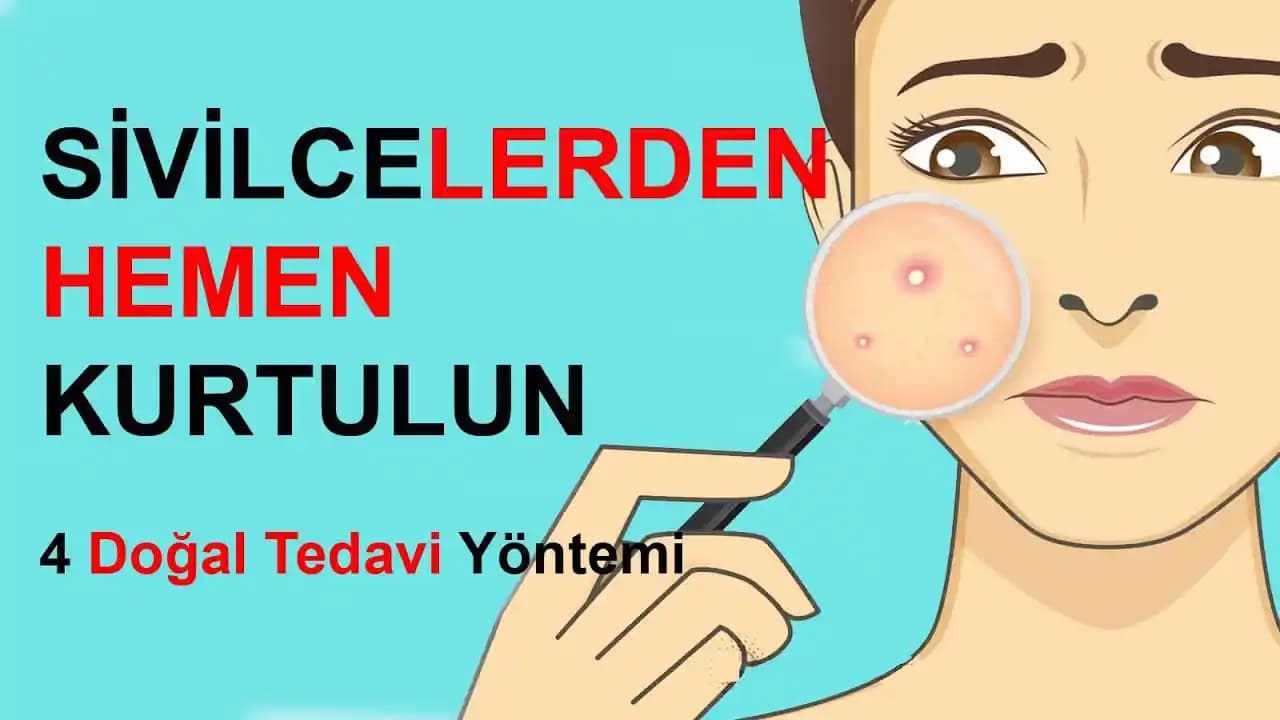 Koldaki Sivilcelere Karşı Etkili Çözümler ve Günlük Bakım İpuçları
