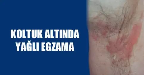 Koltuk Altı Egzaması Nedenleri, Belirtileri ve Kozmetik Yaklaşımlar Rehberi