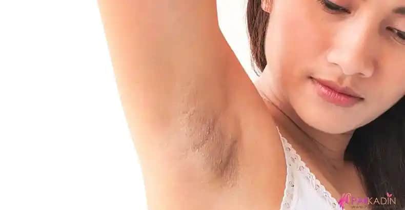 Koltuk Altı Kararmasının Nedenleri ve Etkili Önlemler Hakkında Kapsamlı Bilgi