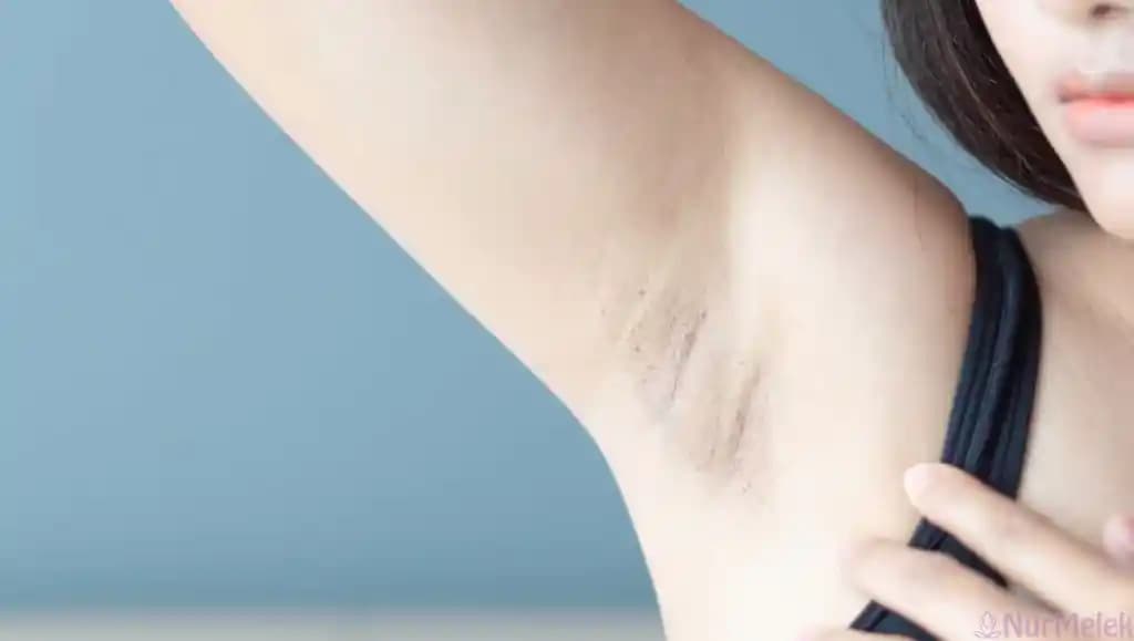 Koltuk Altı Morarması Nedenleri, Önlenmesi ve Etkili Çözüm Yöntemleri